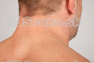 Neck texture of Gene 0001